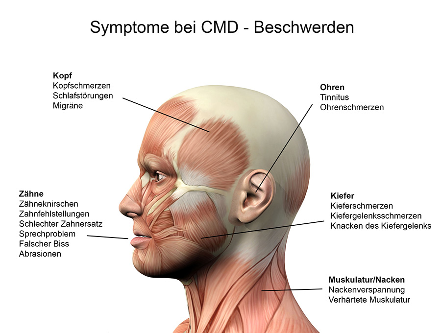 CMD